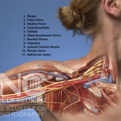 brachialplexus.jpg