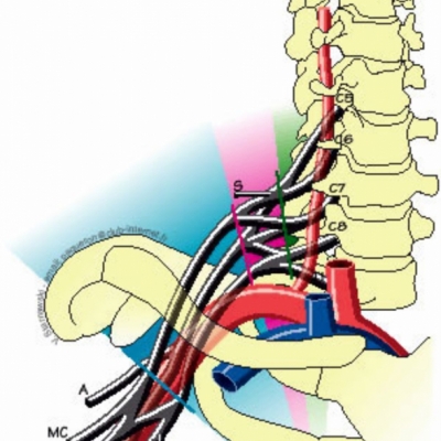 mbrsup_plexus31.jpg